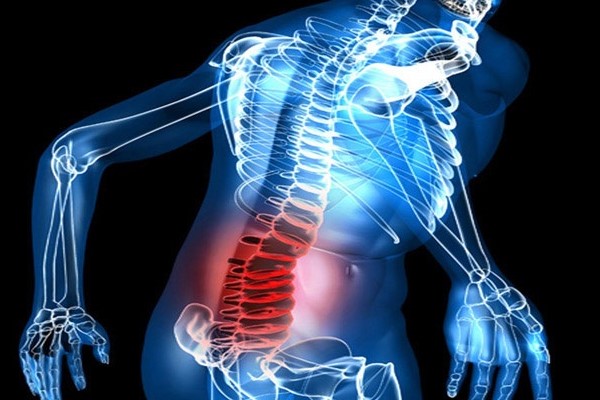 Защемление нерва