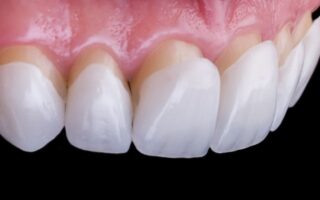 Що таке Вініри