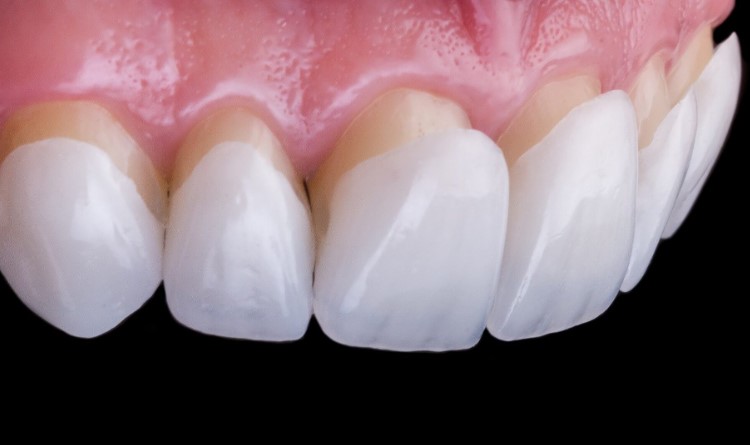 Що таке Вініри