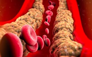 Що таке холестерин в крові