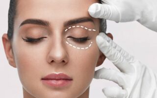 що таке блефаропластика