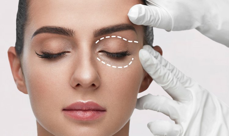 що таке блефаропластика