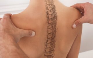 Що таке кіфоз