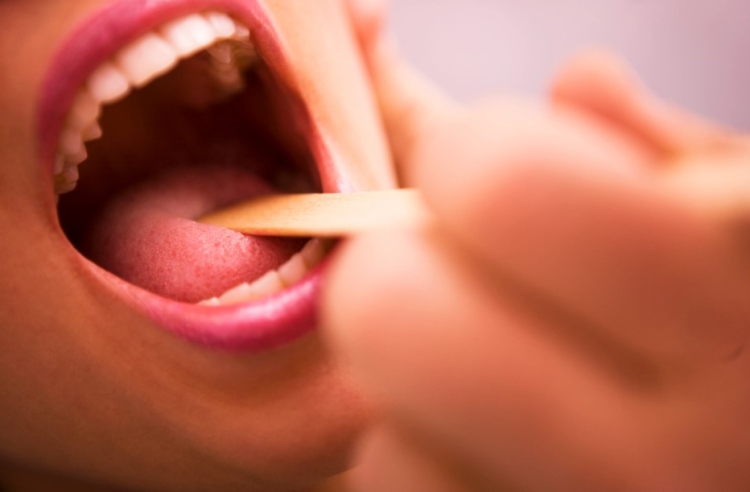 що таке хронічний тонзиліт