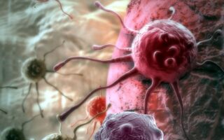 Що таке рецидив раку