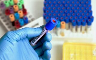 Що таке ревмопроби