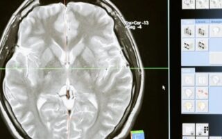 Учені з’ясували справжню причину заїкання