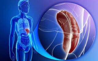 Що таке Спленомегалія. Чому збільшується селезінка